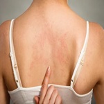 skin-diseases